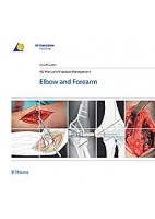 AO MANUAL OF FRACTURE MANAGEMENT. ELBOW & FOREARM
