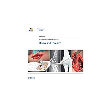 AO MANUAL OF FRACTURE MANAGEMENT. ELBOW & FOREARM