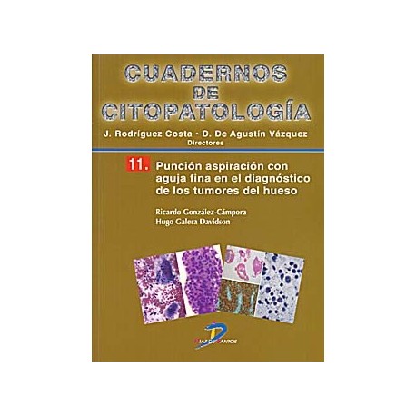 CUADERNOS DE CITOPATOLOGIA 11 (PUNCION ASPIRACION CON AGUJA FINA)