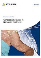 CONCEPTS AND CASES IN NONUNION TREATMENT