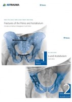 FRACTURES OF THE PELVIS AND ACETABULUM (2 VOL.)