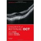 HANDBOOK OF RETINAL OCT: OPTICAL COHERENCE TOMOGRAPHY