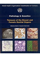PATHOLOGY AND GENETICS TUMOURS OF THE BREAST & FEMALE GENITAL ORGANS