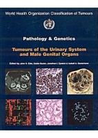 PATHOLOGY AND GENETICS TUMORS OF URINARY SYSTEM & MALE GENITAL ORGANS