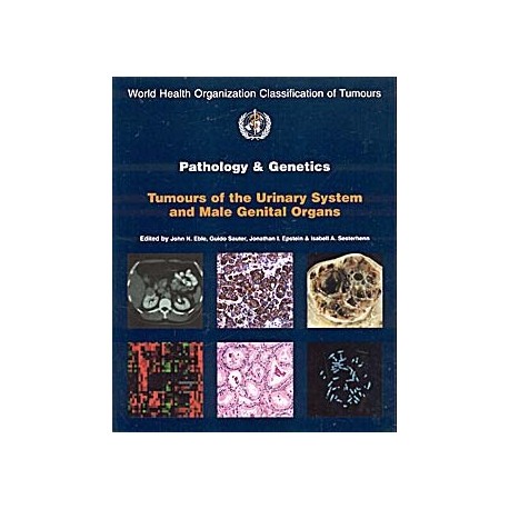 PATHOLOGY AND GENETICS TUMORS OF URINARY SYSTEM & MALE GENITAL ORGANS