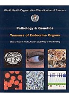 PATHOLOGY AND GENETICS OF TUMOURS OF ENDOCRINE ORGANS