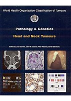 PATHOLOGY AND GENETICS OF HEAD AND NECK TUMOURS