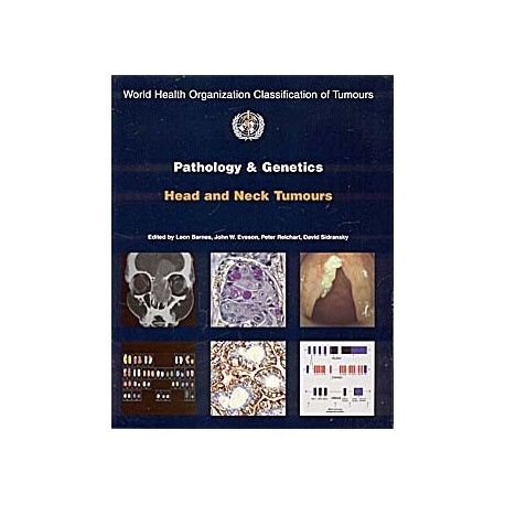 PATHOLOGY AND GENETICS OF HEAD AND NECK TUMOURS