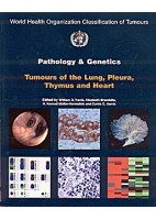 PATHOLOGY AND GENETICS OF TUMOURS OF THE LUNG, PLEURA THYMUS AND HEART