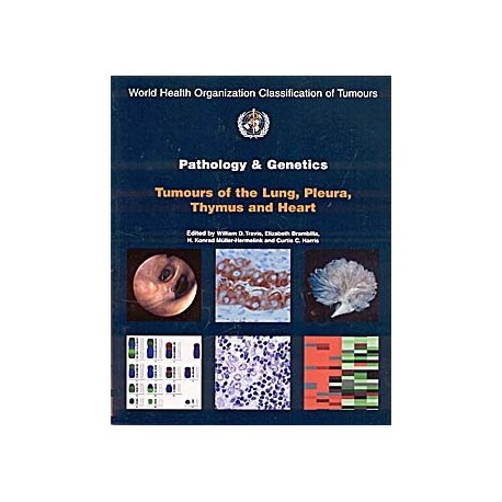 PATHOLOGY AND GENETICS OF TUMOURS OF THE LUNG, PLEURA THYMUS AND HEART