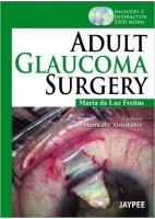 ADULT GLAUCOMA SURGERY + 2 DVD