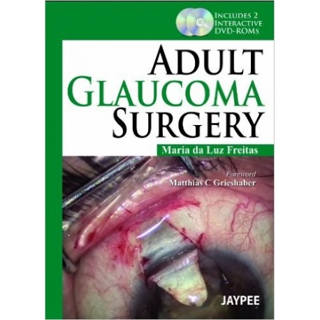 ADULT GLAUCOMA SURGERY + 2 DVD
