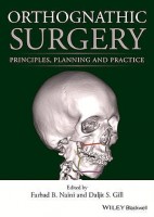 ORTOGNATHIC SURGERY. PRINCIPLES, PLANNING AND PRACTICE