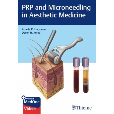 PRP AND MICRONEEDLING IN AESTHETIC MEDICINE + ONLINE AT MEDONE VIDEOS