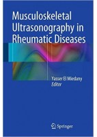 MUSCULOSKELETAL ULTRASONOGRAPHY IN RHEUMATIC DISEASES