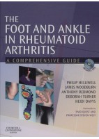 THE FOOT AND ANKLE IN RHEUMATOID ARTHRITIS
