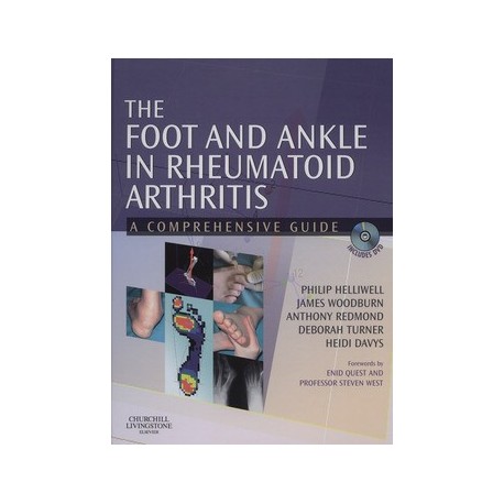 THE FOOT AND ANKLE IN RHEUMATOID ARTHRITIS