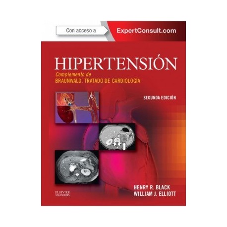HIPERTENSION + EXPERT CONSULT