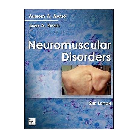 NEUROMUSCULAR DISORDERS
