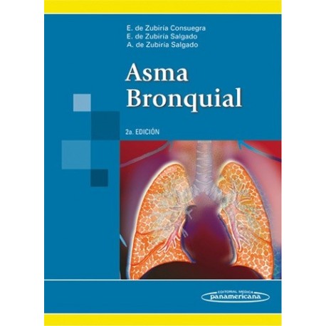 ASMA BRONQUIAL