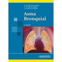 ASMA BRONQUIAL