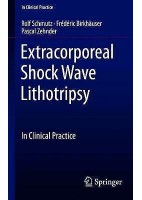EXTRACORPOREAL SHOCK WAVE LITHOTRIPSY. CLINICAL PRACTICE