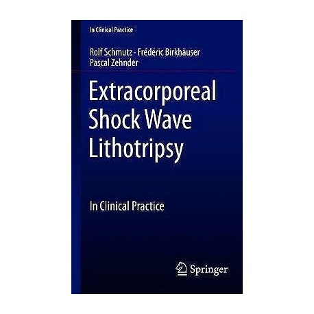 EXTRACORPOREAL SHOCK WAVE LITHOTRIPSY. CLINICAL PRACTICE