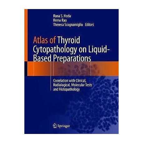 ATLAS OF THYROID CYTOPATHOLOGY ON LIQUID-BASED PREPARATIONS