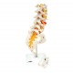 MODELO COLUMNA VERTEBRAL LUMBAR CON HERNIA DISCAL DORSOLATERAL