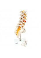 MODELO COLUMNA VERTEBRAL LUMBAR CON HERNIA DISCAL DORSOLATERAL