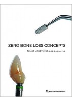 ZERO BONE LOSS CONCEPTS