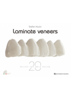 LAMINATE VENEER 20 RECIPES FOR SMILE DESIGN