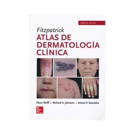 FITZPATRICK ATLAS DE DERMATOLOGIA CLINICA