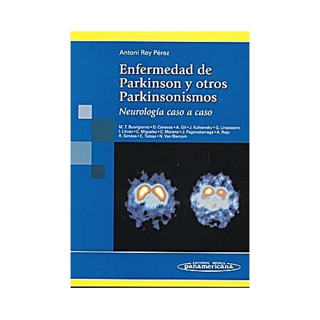 ENFERMEDAD DE PARKINSON Y OTROS PARKINSONISMOS. NEUROLOGIA CASO A CASO