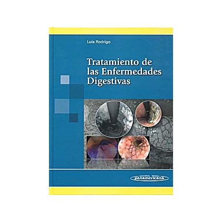 TRATAMIENTO DE LAS ENFERMEDADES DIGESTIVAS