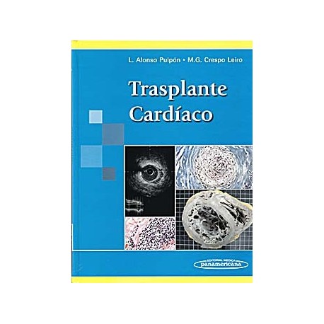 TRASPLANTE CARDIACO