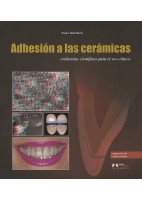 ADHESION A LAS CERAMICAS. EVIDENCIAS CIENTIFICAS PARA EL USO CLINICO