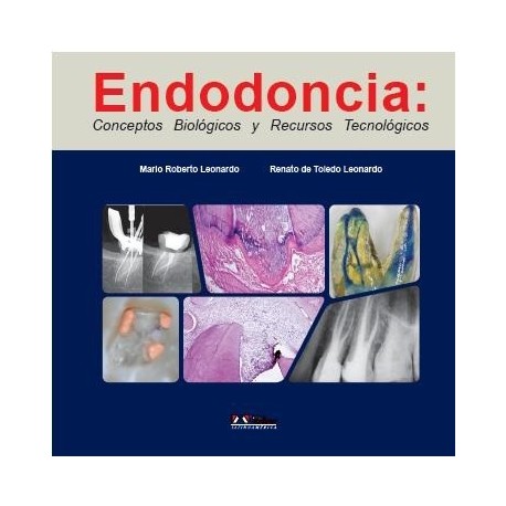 ENDODONCIA. CONCEPTOS BIOLOGICOS Y RECURSOS TECNOLOGICOS