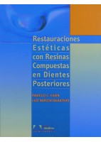 RESTAURACIONES ESTETICAS CON RESINAS COMPUESTAS EN DIENTES POSTERIORES