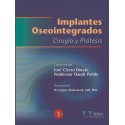 IMPLANTES OSTEOINTEGRADOS. CIRUGIA Y PROTESIS