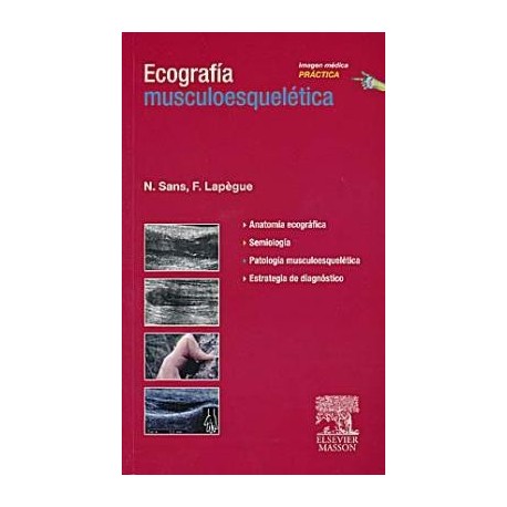 ECOGRAFIA MUSCULOESQUELETICA