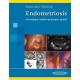 ENDOMETRIOSIS. UN ENFOQUE MEDICO-QUIRURGICO GLOBAL