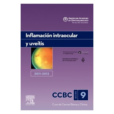 INFLAMACION INTRAOCULAR Y UVEITIS. 2011-2012: SECCION 9