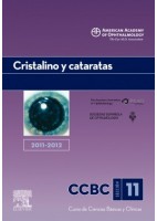 CRISTALINO Y CATARATAS. 2011-2012: SECCION 11
