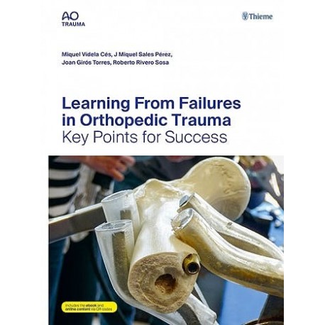 LEARNING FROM FAILURES IN ORTHOPEDIC TRAUMA. KEY POINTS FOR SUCCESS