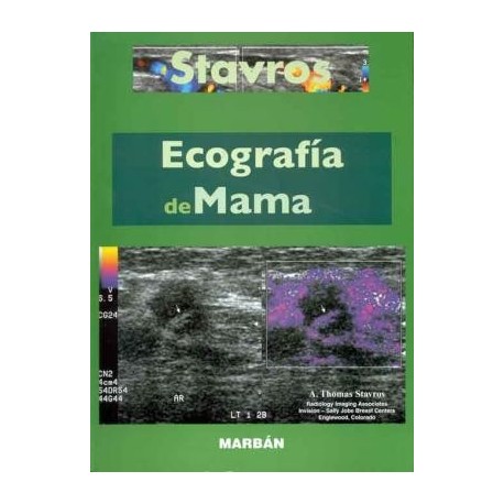 ECOGRAFIA DE MAMA. TAPA DURA