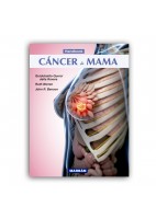 CANCER DE MAMA HANDBOOK