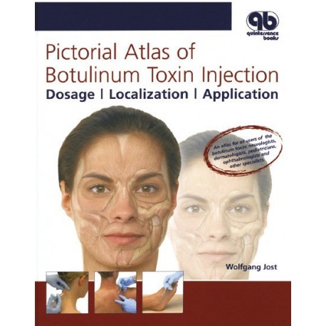 PICTORIAL ATLAS OF BOTULINUM TOXIN INJECTION