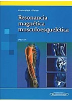 RESONANCIA MAGNETICA MUSCULOESQUELETICA