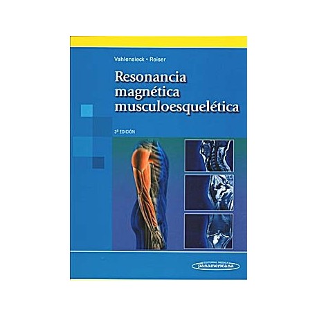 RESONANCIA MAGNETICA MUSCULOESQUELETICA